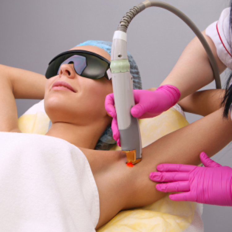 Laser Hair removal