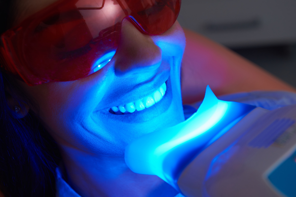 Teeth Whitening at our Clinic