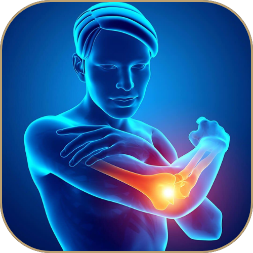 Hội chứng Tennis Elbow là tình trạng khuỷu tay bị viêm đau, đặc biệt ở điểm bám gân cơ cẳng tay