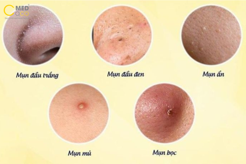 cham-soc-da-mun