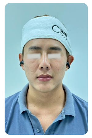 Liệu trình trẻ hoá da tại CocoMed Quận 2, TP. HCM