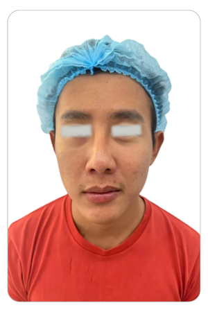 Liệu trình trẻ hoá da tại CocoMed Quận 2, TP. HCM