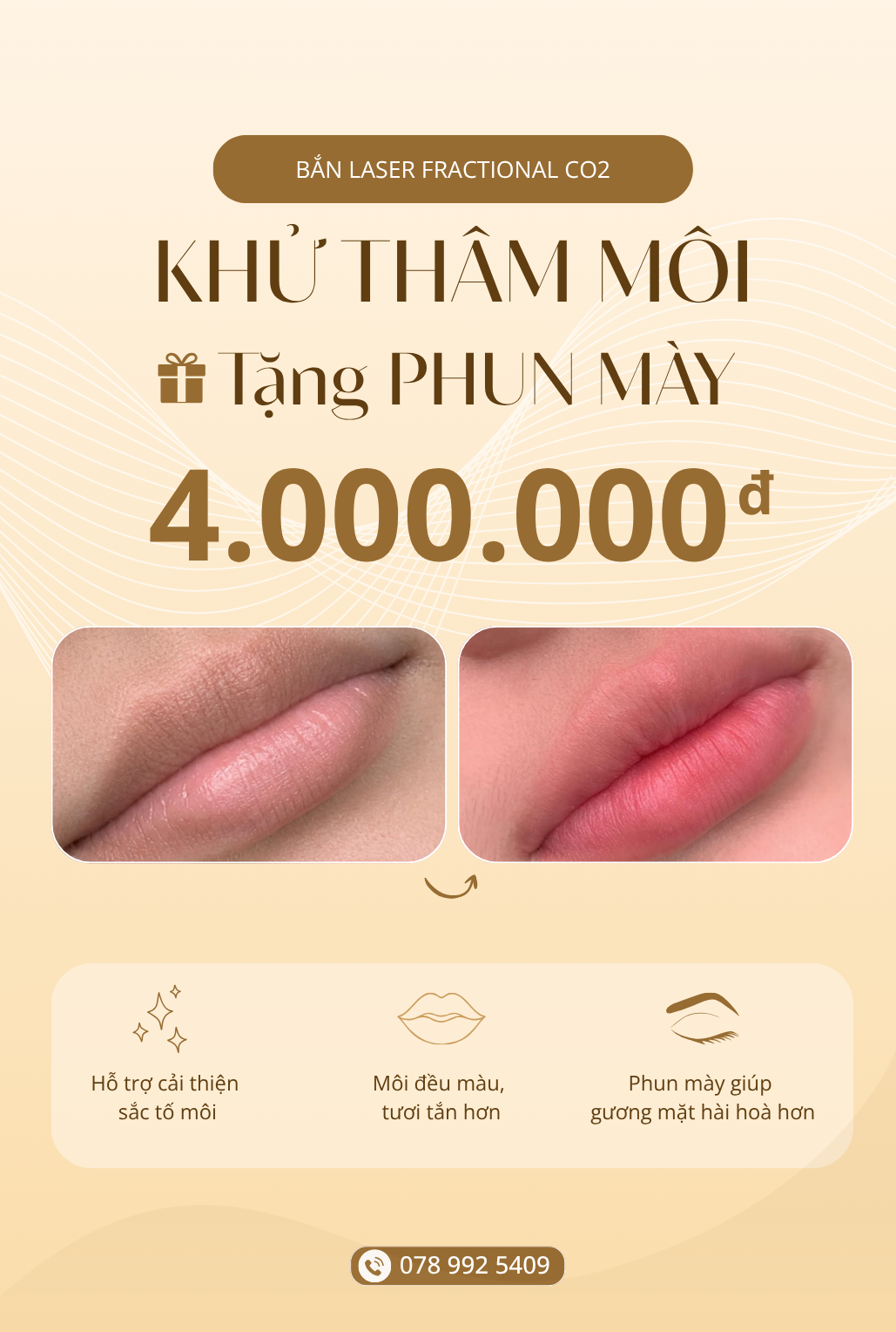 Ưu đãi khử thâm môi tặng phun mày giá chỉ 4 triệu