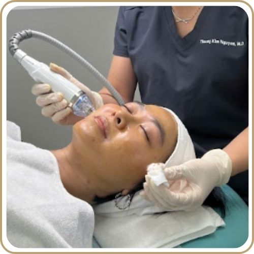 Điều trị sẹo rỗ bằng phương pháp RF Microneedling