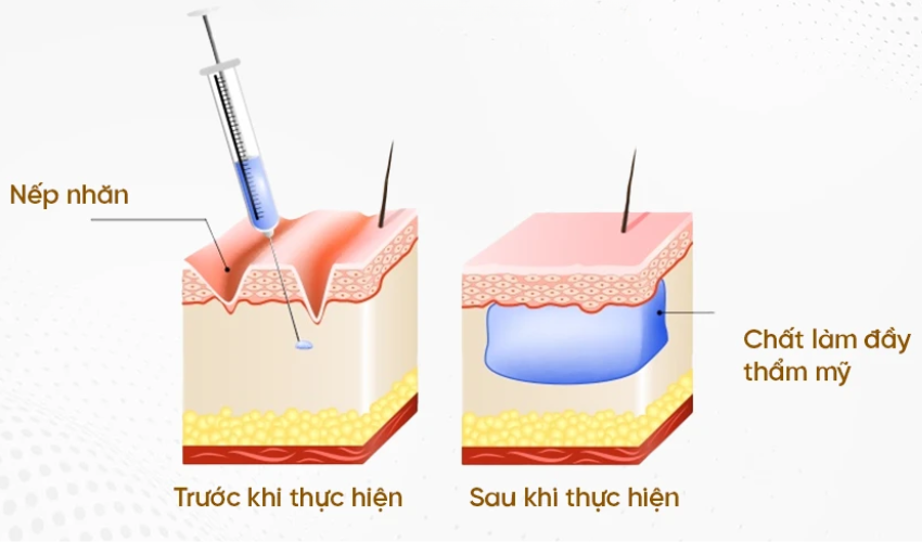 cơ chế hoạt động của hoạt chất HA